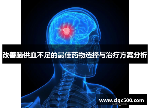 改善脑供血不足的最佳药物选择与治疗方案分析